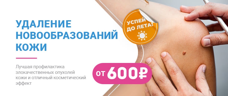 Удаление новообразований кожи
